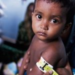 Malnutrition explained easily