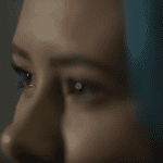Girl gets Gonorrhea in her Eye
